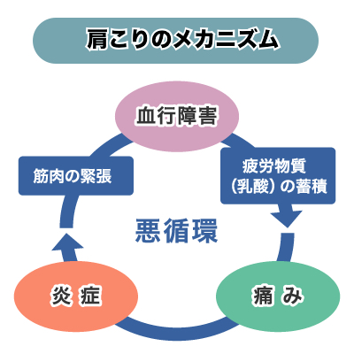 肩こりのメカニズム