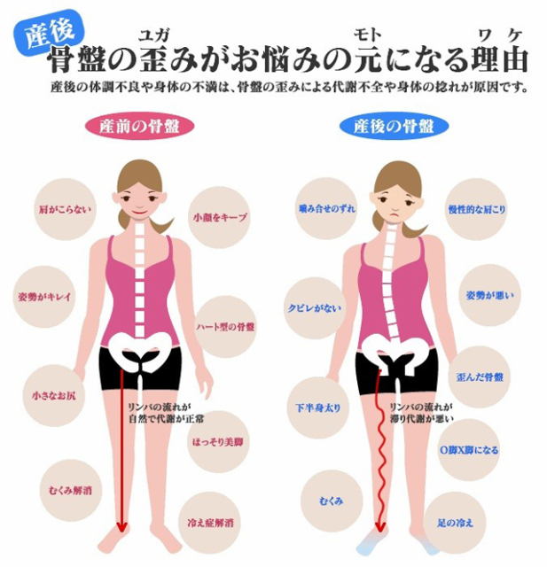 産後骨盤矯正